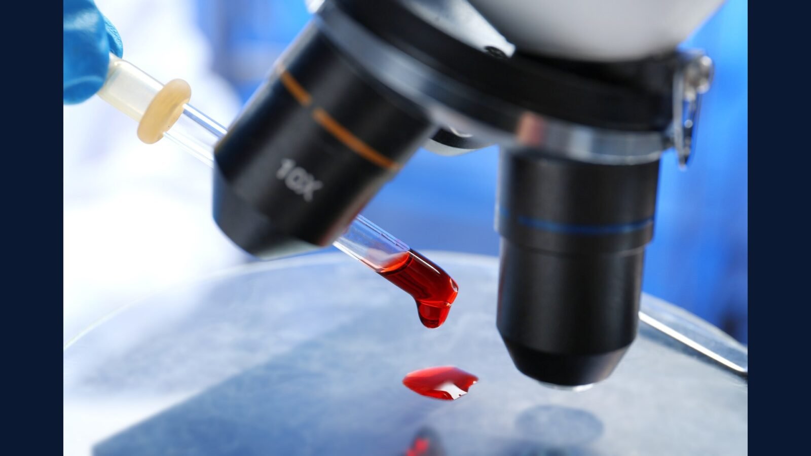 RSS patologia clínica: hemograma, bioquímica, lab