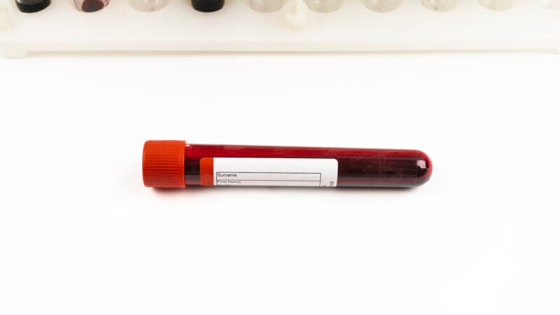 Trabalhador exposto a mercúrio, formaldeído ou glutaraldeído: o exame toxicológico que protege o empregador